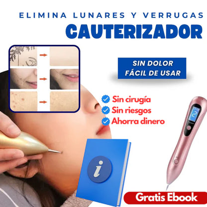 Elimina imperfecciones al instante con la Pluma Laser